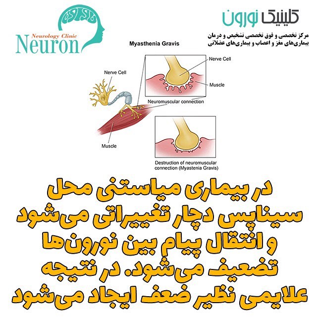 کلینیک مغز و اعصاب اصفهان