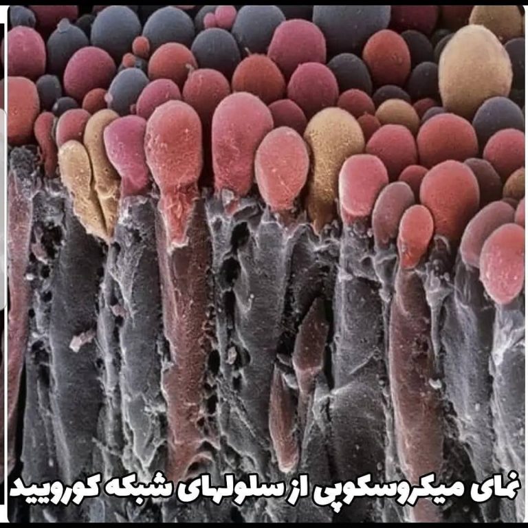 شبکه-کورویید