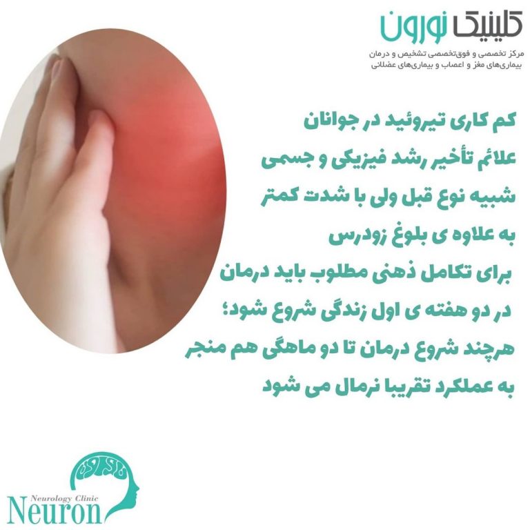 کم کاری تیروئید با مغز و سیستم عصبی چه میکند؟