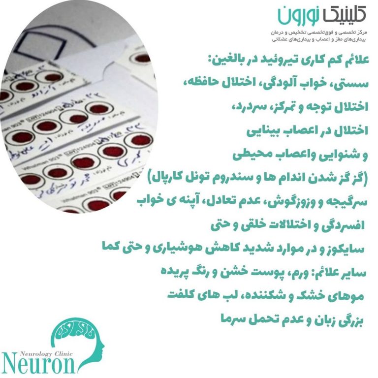 کم کاری تیروئید با مغز و سیستم عصبی چه میکند؟