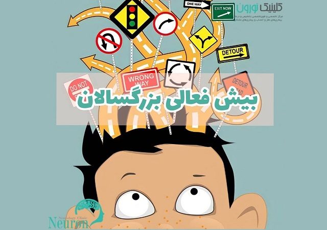 بیش فعالی در بزرگسالان