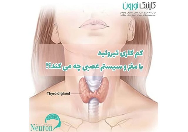 بهترین کاردرمانی اصفهان, بهترین متخصص مغز اعصاب اصفهان, بهترین متخصص مغز و اعصاب اصفهان, کلینیک تخصصی مغز و اعصاب, کلینیک تخصصی مغز و اعصاب اصفهان, کلینیک تخصصی مغز و اعصاب نورون, کلینیک مغز و اعصاب اصفهان, کلینیک نورون, مرکز تخصصی و فوق تخصصی مغز، اعصاب و روان نورون
