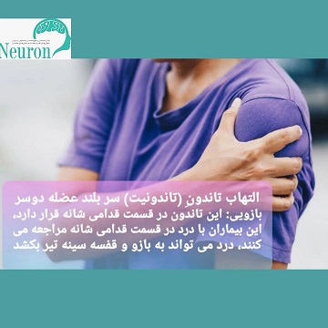 تاندونیت عضله دوسربازویی