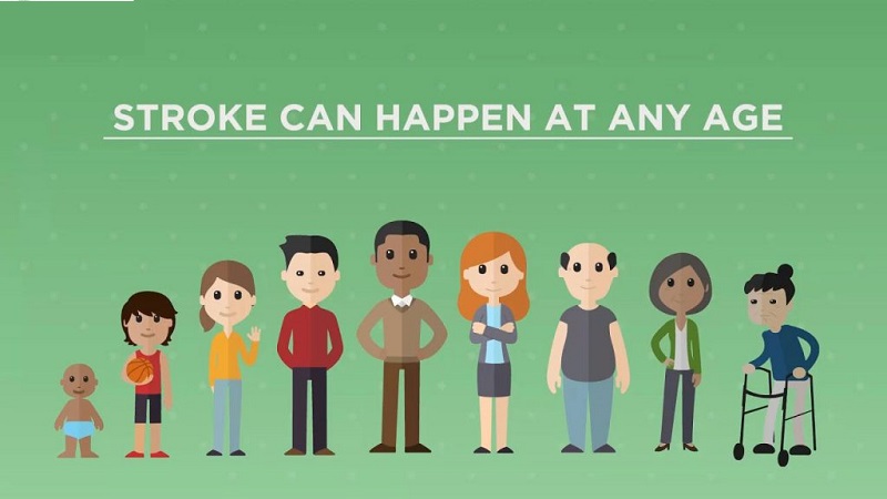 علل و علائم سکته مغزی در جوانان و کودکان