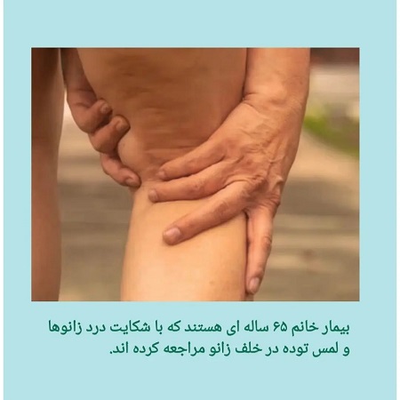 درد زانو با معرفی یک بیمار | کلینیک مغز و اعصاب اصفهان