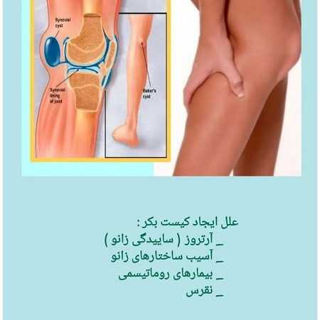 درد زانو با معرفی یک بیمار | کلینیک مغز و اعصاب اصفهان