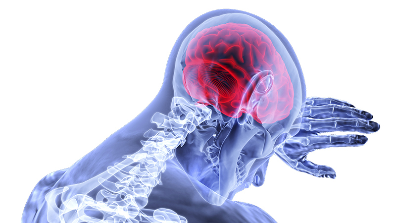 علل افزایش ریسک سکته مغزی شدید