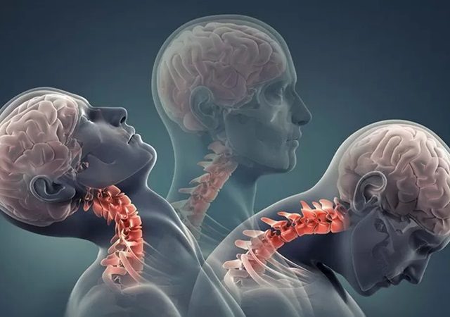 بررسی آسیب‌های مغزی | کلینیک مغز و اعصاب اصفهان | کلینیک تخصصی مغز و اعصاب نورون