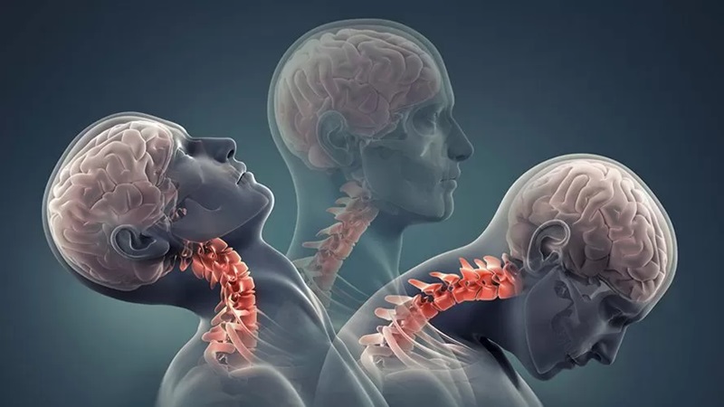 بررسی آسیب‌های مغزی | کلینیک مغز و اعصاب اصفهان | کلینیک تخصصی مغز و اعصاب نورون