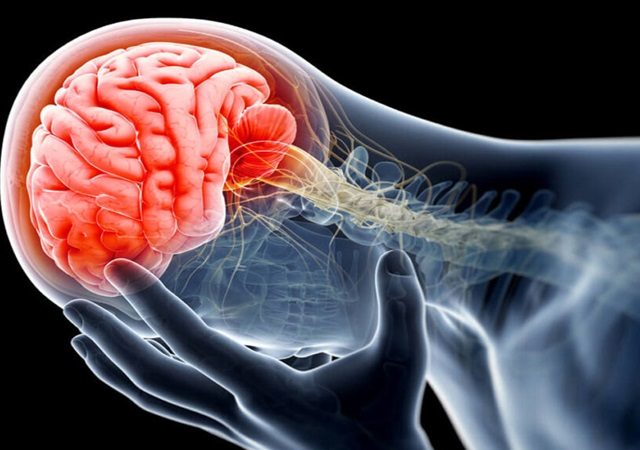 بیماری‌های نادر مغز و اعصاب | کلینیک مغز و اعصاب اصفهان | کلینیک تخصصی مغز و اعصاب نورون