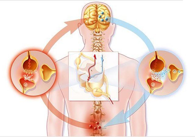 بررسی سندرم گیلن باره | کلینیک مغز و اعصاب اصفهان | کلینیک تخصصی مغز و اعصاب نورون