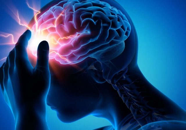 کلینیک مغز و اعصاب اصفهان | کلینیک تخصصی مغز و اعصاب نورون