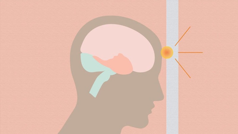 صدمات مغزی تروماتیک (TBI) | کلینیک مغز و اعصاب اصفهان | کلینیک تخصصی مغز و اعصاب نورون