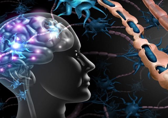 بیماری ام اس (MS) | کلینیک مغز و اعصاب اصفهان | کلینیک تخصصی مغز و اعصاب نورون